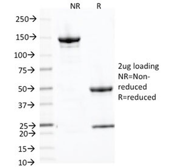 Placental Alkaline Phosphatase Antibody / ALPP