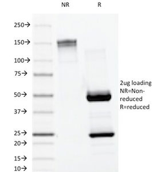 Lambda Antibody