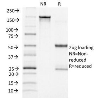 ACTH Antibody