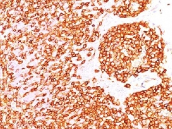 CD45 Antibody (Leukocyte marker)