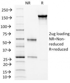CD105 Antibody / Endoglin