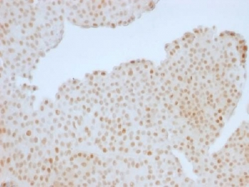 Retinoblastoma Antibody / Rb1
