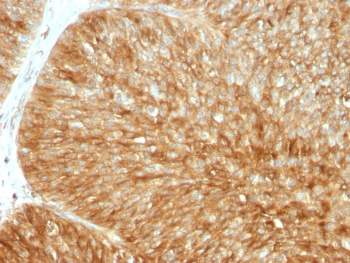 Beta-2 Microglobulin Antibody