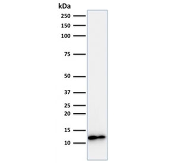 Beta-2 Microglobulin Antibody