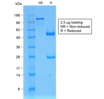 Beta-2 Microglobulin Antibody