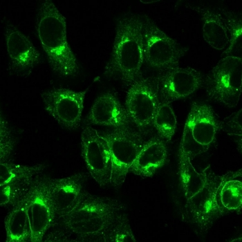 Beta-2 Microglobulin Antibody