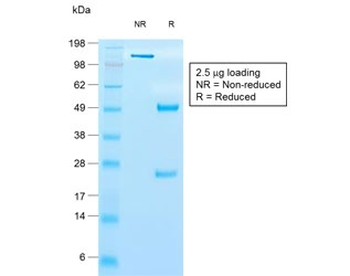 Recombinant TIMP1 Antibody