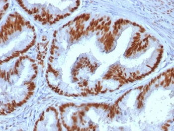 Estrogen Receptor alpha Antibody