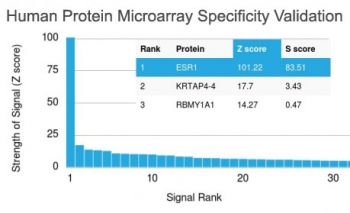 Estrogen Receptor alpha Antibody