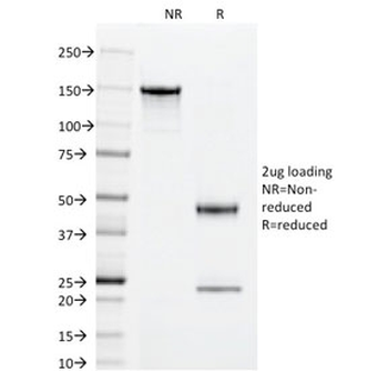 SOD1 Antibody / Superoxide Dismutase 1