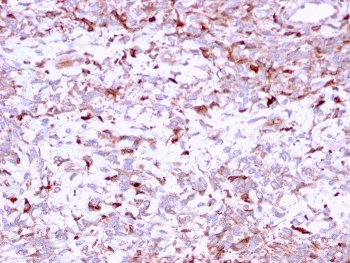 Cathepsin K Antibody / CTSK