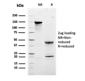 Calbindin 2 Antibody / CALB2 / Calretinin