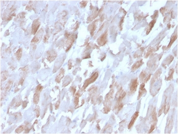 ACTN2 Antibody / Alpha Actinin 2 / Sarcomeric Alpha Actinin