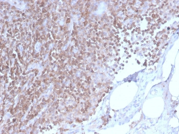 CD3 epsilon Antibody
