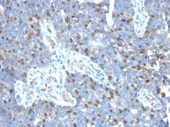 RORC Antibody
