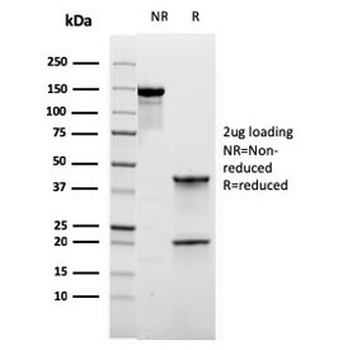 RORC Antibody