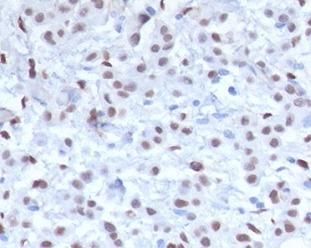 Recombinant Wilms Tumor 1 Antibody