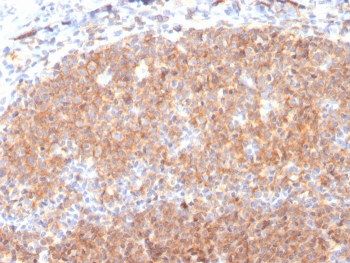 CD19 Antibody / B-lymphocyte marker