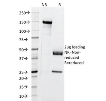 Cytokeratin 5/6/18 Antibody