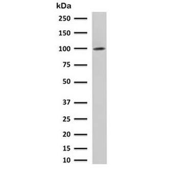 Folate Hydrolase 1 Antibody / FOLH1 / PSMA