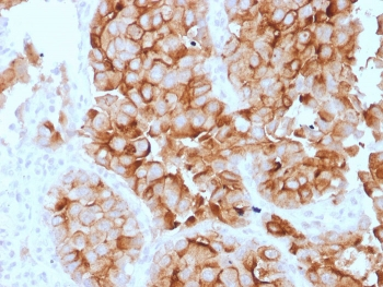 Mesothelin Antibody / MSLN