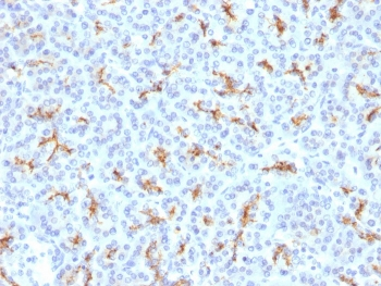 CFTR Antibody / Cystic Fibrosis Transmembrane Regulator