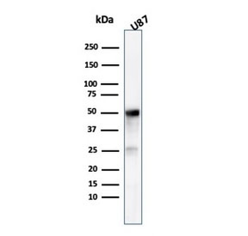 Beta Tubulin Antibody / TUBB3