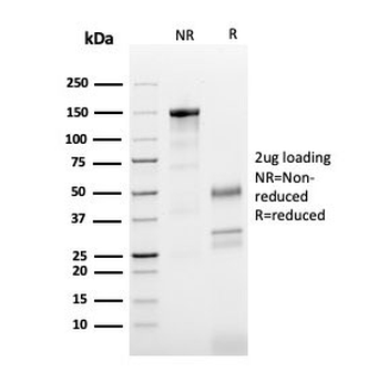 Beta Tubulin Antibody / TUBB3