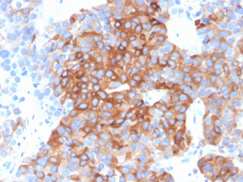 Beta Tubulin Antibody / TUBB3