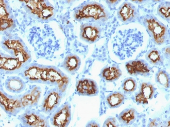 CFTR Antibody / Cystic Fibrosis Transmembrane Regulator