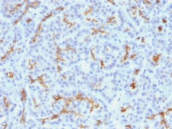 CFTR Antibody / Cystic Fibrosis Transmembrane Regulator