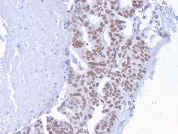 CHD4 Antibody / Chromodomain helicase DNA binding protein 4