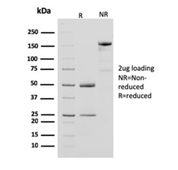CKB Antibody / Creatine Phosphokinase-BB