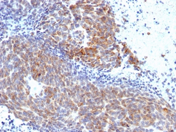 TOP1MT Antibody / Topoisomerase I mitochondrial