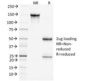 Clathrin Heavy Chain Antibody