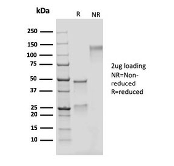 Adipophilin Antibody / Perilipin 2 / ADRP / PLIN2