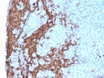 CSF3 Antibody / Granulocyte-Colony Stimulating Factor