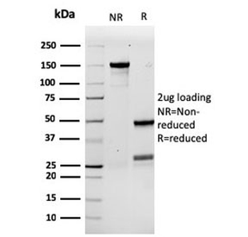 CSF3 Antibody / Granulocyte-Colony Stimulating Factor