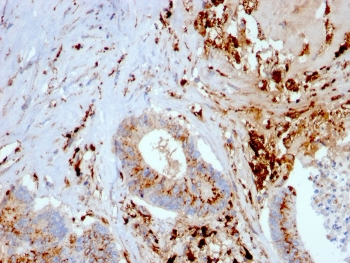 CTSD Antibody / Cathepsin D