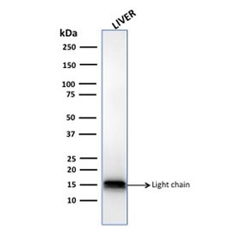CTSD Antibody / Cathepsin D