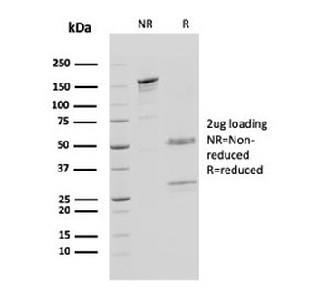 CTSD Antibody / Cathepsin D