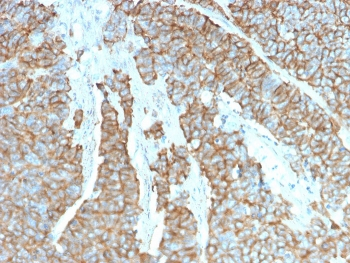 Drebrin 1 Antibody