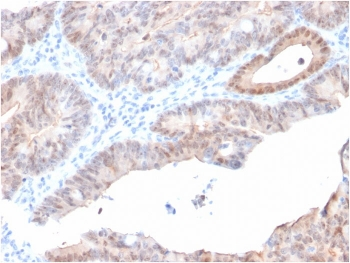 AKR1C2 Antibody