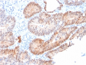 AKR1C2 Antibody