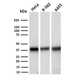 AKR1C2 Antibody