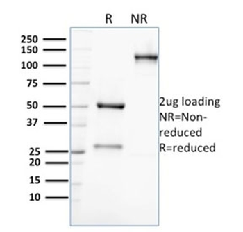 AKR1C2 Antibody