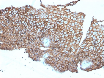 Desmoglein 3 Antibody / DSG3