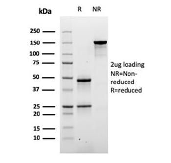 Desmoglein 3 Antibody / DSG3