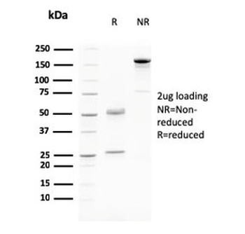 Desmoglein 3 Antibody / DSG3