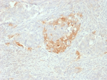 NSE Antibody / Neuron Specific Enolase